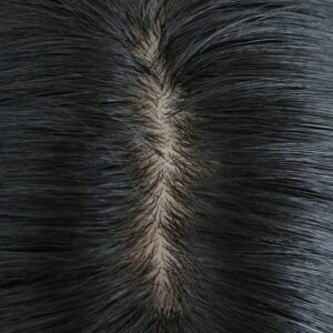 Injection Skin with Diamond Net in Body hair systems center1