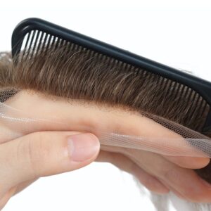 Lace Covering Receding Hairline
