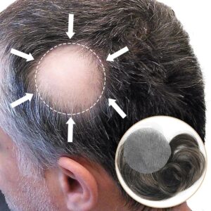 Side/Back Hair Patches for Men Covering Bald Spots on Head Hair Systems Front