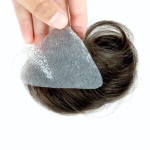 Temple Hair Patches Covering Bald Temples