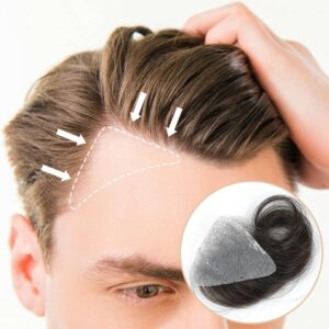 Temple Hair Patches Covering Bald hair Systems